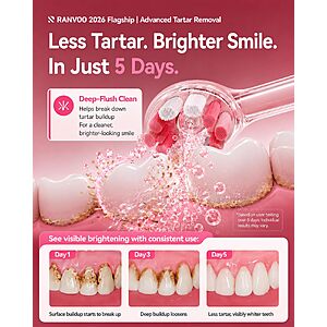 RANVOO AirJet X5 Electric Toothbrush, Dentist Recommended, Pink